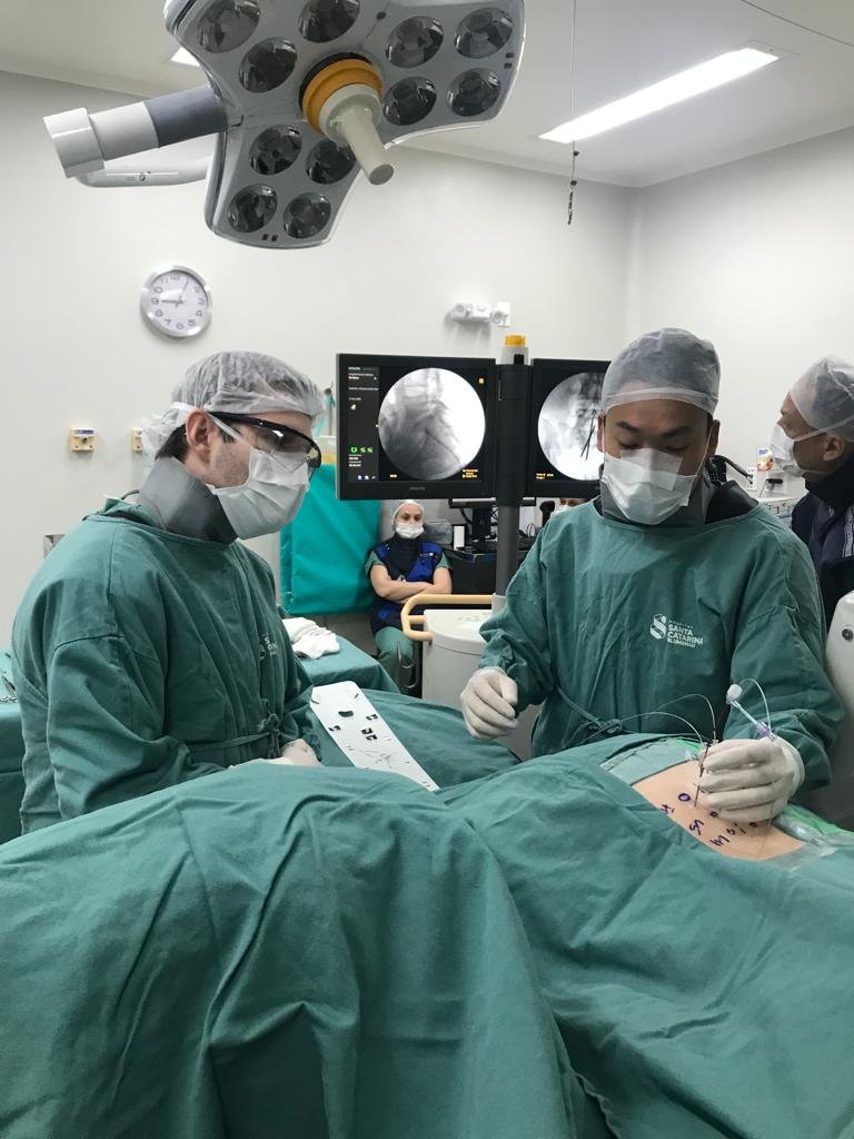 procedimento cirurgico com implante de eletrodo percutâneo para estimulação do gânglio da raiz dorsal