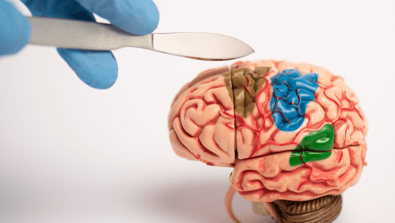 Neurocirurgia para Parkinson pode auxiliar de forma significativa na qualidade de vida dos pacientes com mal de Parkinson. Dr Wilson Morikawa